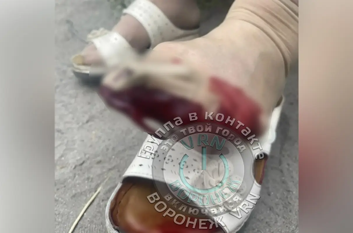 Очевидец: пожилая женщина серьезно повредила ногу после падения в воронежском автобусе
